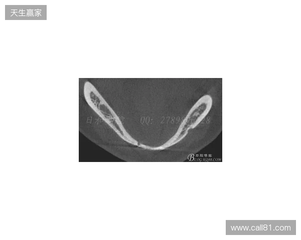 韦林顿确诊上唇部贯通伤；11、21牙半脱位；上颌前牙区牙槽骨骨折